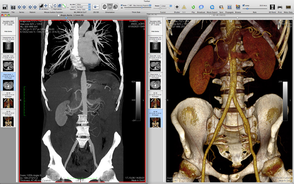 3dicom_8