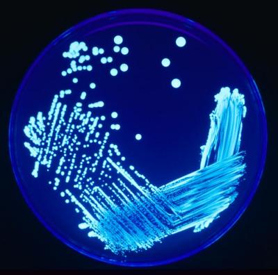 La legionella, el visitante no deseado del verano: s�ntomas, prevenci�n, desinfecci�n